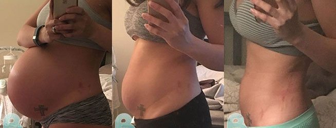 How long after pregnancy will it take to lose the weight
